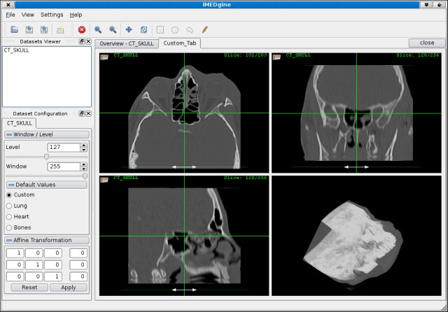 Imedgine Screenshot